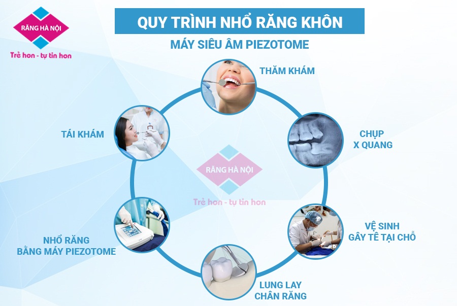Quy trình nhổ răng